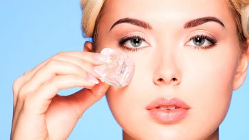 Bruises under the eyes