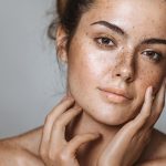 Пигментные пятна: что это такое и какие существуют виды 17 Dark spots