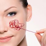 Что такое купероз: причины и варианты лечения 16 What is kuperoz