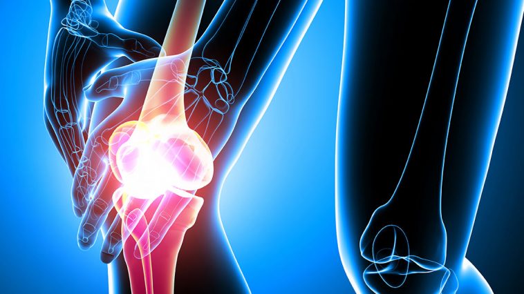 Arthritis and arthrosis