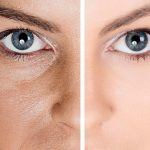 Как сузить поры на лице и избавится от черных точек 20 The pores on the face