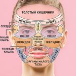 Высыпание на лице: на что указывают прыщики в разных зонах? 16 Pimples face