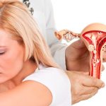 Вагинит: основные симптомы, причины появления и лечение 12 Vaginitis