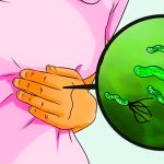 Диета при хеликобактер пилори: что можно есть, а что нельзя 17 Helicobacter pylori