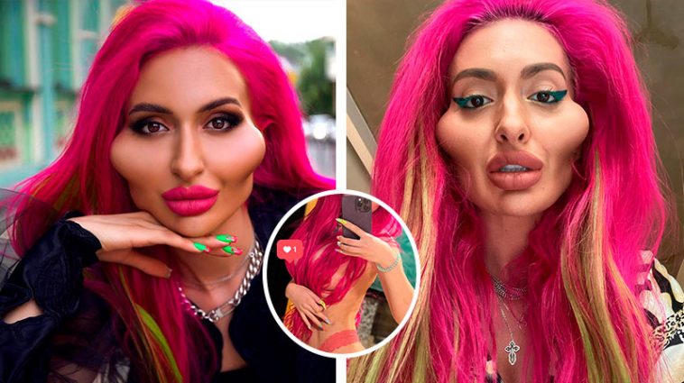 Украинка с самыми большими скулами засветила обнаженную грудь после её увеличения 6 Покрещук 3