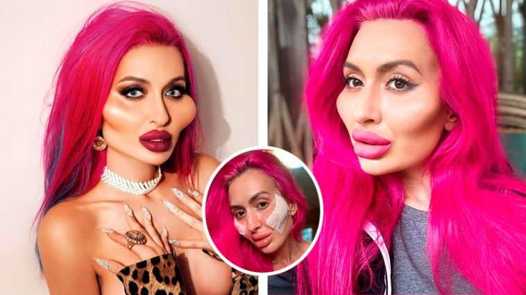 Украинка с самыми большими скулами в мире, показала фото как выглядит без макияжа 6 Покрещук