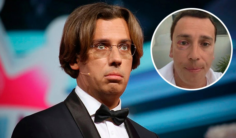 Maket Moldova 1650871362 34