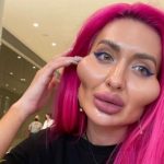 "Прогресс налицо" - украинка с самыми большими скулами продемонстрировала результат очередной операции 11 instagram com just queen 1 1300x820 e1654634313309