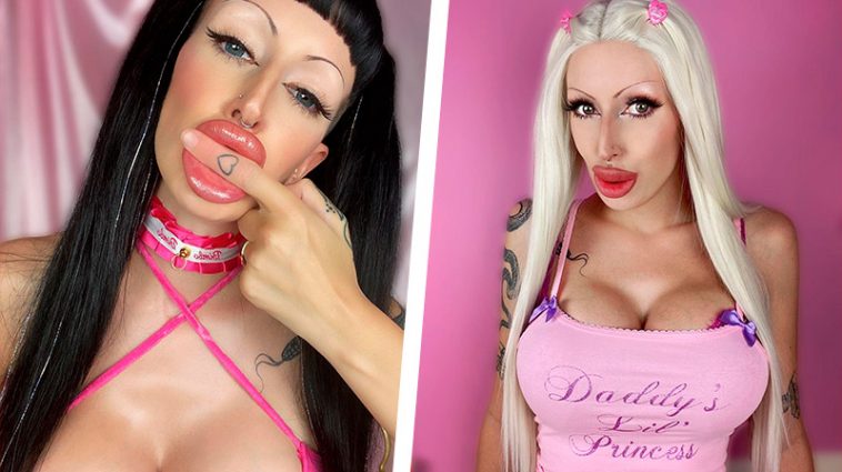 31-летняя британка потратила 25 000 фунтов, чтобы стать похожей на Памелу Андерсон, а превратилась в трансгендера 6 6