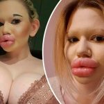 "Меня не беспокоит мнение других!" - обладательница самых больших губ в мире увеличит ещё одну часть тела 14 Maket Moldova 1650871362 128