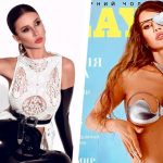 "Выстрел уже был просто мне в голову" - героиня Playboy, которая потеряла из-за войны глаз, рассказала, как борется за жизнь 15 6 7