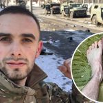 "Так зачем ты ногу оставлял?!" - в Харьковском МСЭК ветерану предложили отрезать ногу, чтобы получить инвалидность 14 Maket Moldova 1650871362 47