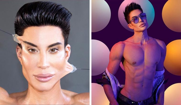 «Я потратил на пластические операции более миллиона долларов»: Как сейчас выглядит живой «Кен» - американец Джастин Джедлика 6 для кена1