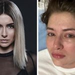 Актрису Екатерину Тышкевич вывели из медикаментозного сна: врачи впервые дали обнадеживающий прогноз по ее состоянию здоровья 17 для тишкевич