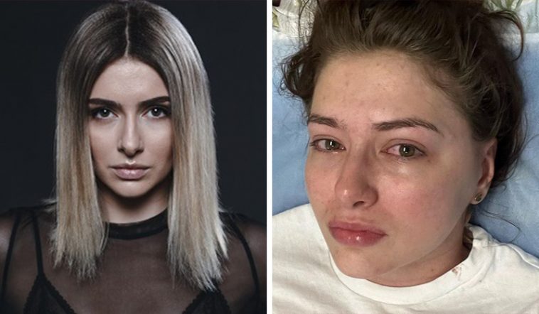 Актрису Екатерину Тышкевич вывели из медикаментозного сна: врачи впервые дали обнадеживающий прогноз по ее состоянию здоровья 6 для тишкевич