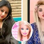 Модель из Ирака перенесла 43 операции и изменилась до неузнаваемости, чтобы походить на Барби 14 sfsfs