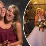 "Пользуются моим органом!" - сиамская близняшка подала в суд на свою сестру, которая вышла замуж 14 Сиамская