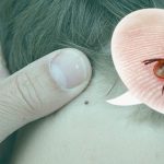 1652979959 hvoroba lajma u kremenchuci