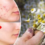 Ромашка: Нежный лекарь в каждом дворе 14 bvdbvjvgrnibhsbhcsdcsjbcj