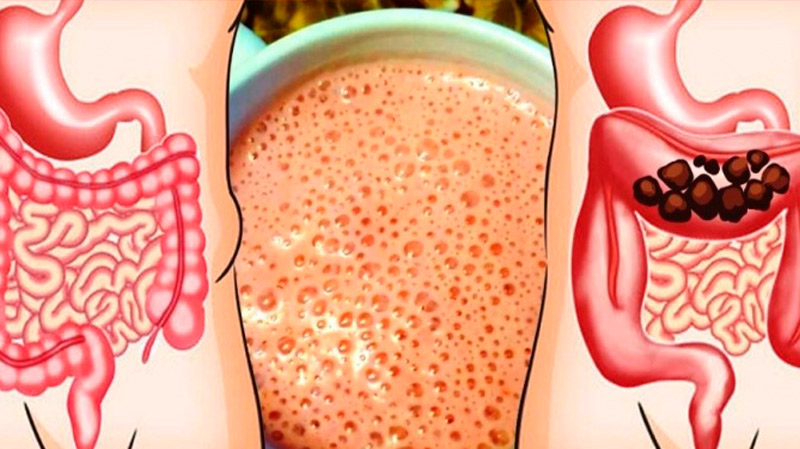 Поддерживайте кишечник в чистоте: 7 натуральных средств для мягкого очищения