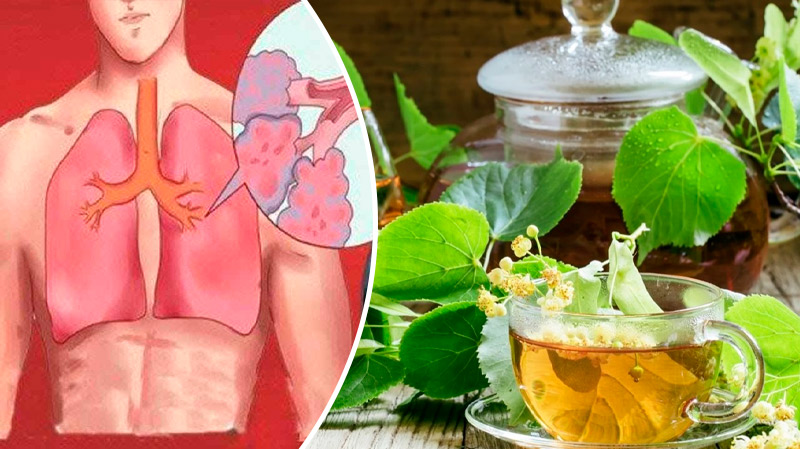 Липа — природное сокровище для здоровья 9 Липа — природное сокровище для здоровья