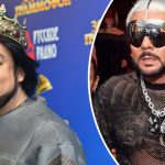 Сочится что-то жёлтое: Филипп Киркоров показался в бутике с грязным бинтом на незаживающей руке 13 bvdbvjdjvgrnibhsbcsjbcj