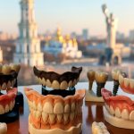 Новые зубы — новая жизнь: протезирование в клинике Crystal Dent 12 Новые зубы — новая жизнь: протезирование в клинике Crystal Dent