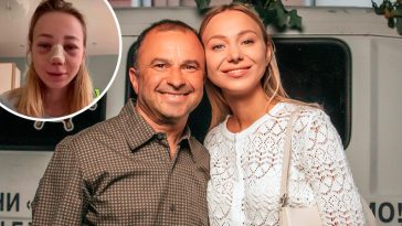 Жена Виктора Павлика поделилась трагическим опытом: неудачная коррекция подбородка