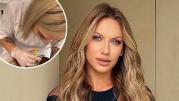 38-летняя Леся Никитюк освежила внешность с помощью филеров: косметологиня раскрыла подробности. Фото