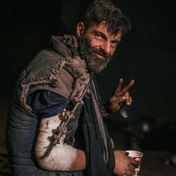 Михаил Дианов поразил сеть результатом реабилитации: как изменился легендарный защитник «Азовстали» 2 Михаил Дианов